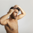 Trapianto di capelli: Ecco le domande più frequenti.