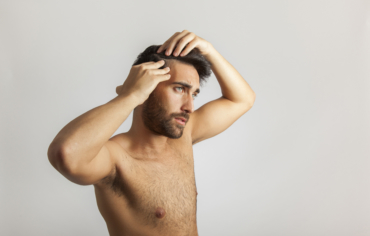 Trapianto di capelli: Ecco le domande più frequenti.